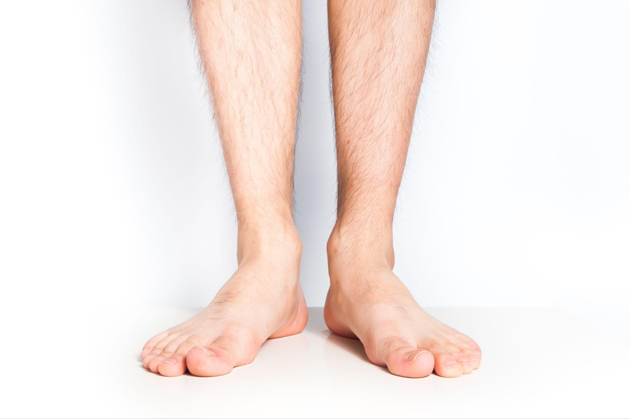 足の裏の熱さに関連する疾患